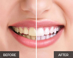 General and Cosmetic dentist in Dubai
